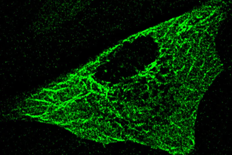 Super-ločljivostni mikroskop za opazovanje živih celic ZEISS ELYRA 7 Lattice SIM
